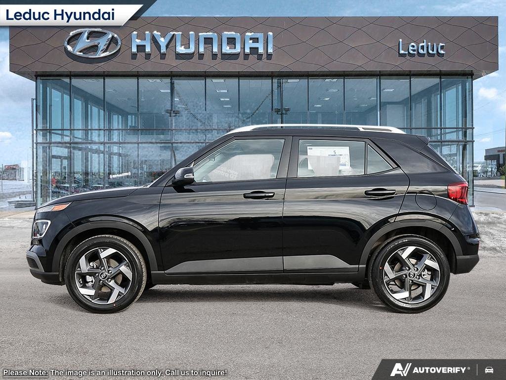 2025 Hyundai Venue Ultimate - Black interior in Leduc, Alberta - 3 - w1024h768px