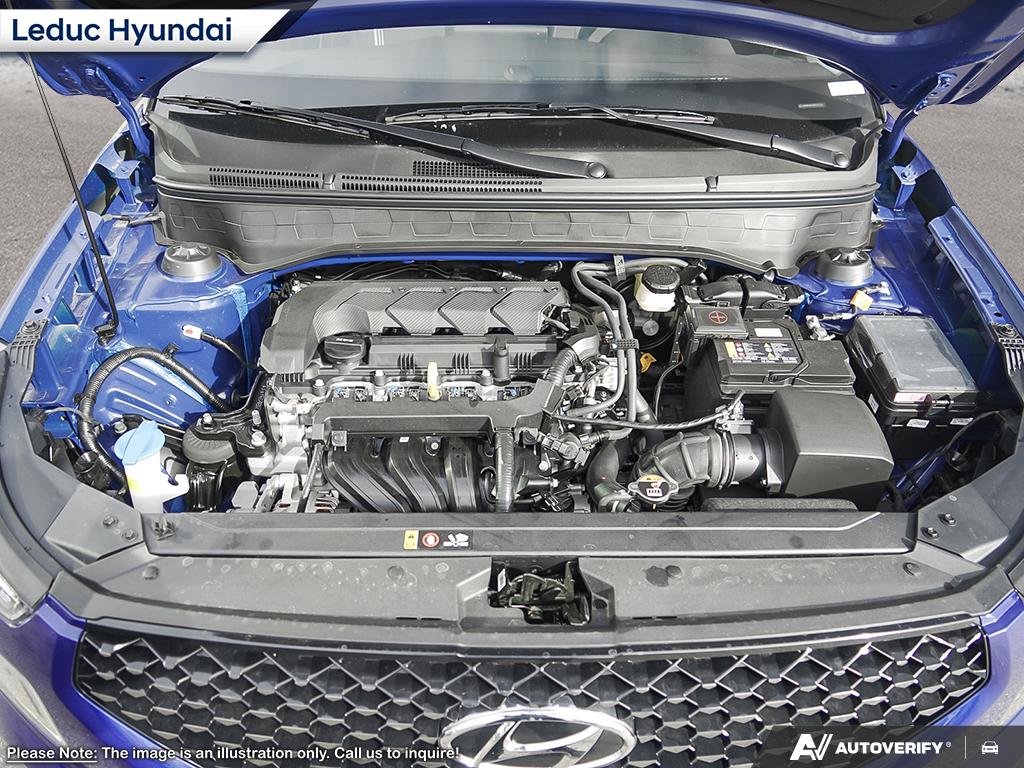 2025 Hyundai Venue Ultimate - Black interior in Leduc, Alberta - 6 - w1024h768px