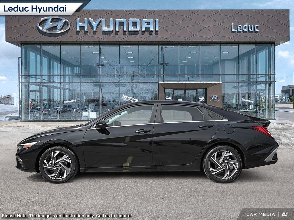 2025 Hyundai Elantra LUXURY in Leduc, Alberta - 3 - w1024h768px