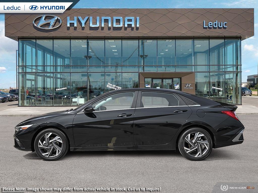 2025  Elantra LUXURY in Leduc, Alberta - 3 - w1024h768px