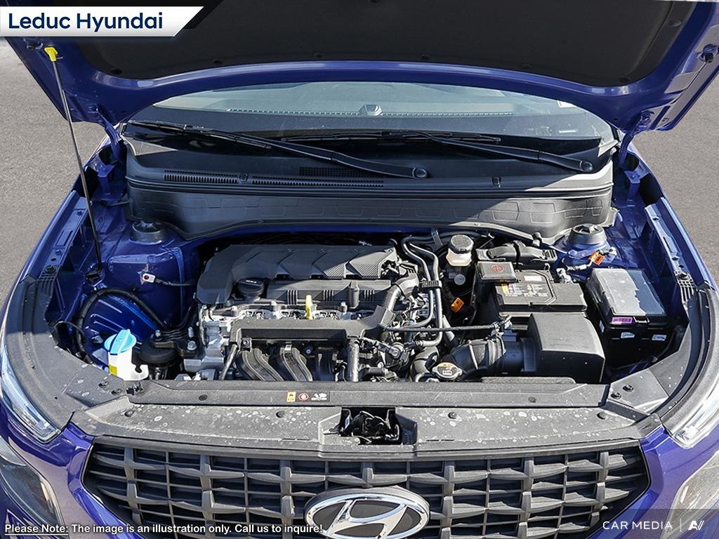 2025 Hyundai Venue ESSENTIAL in Leduc, Alberta - 6 - w1024h768px