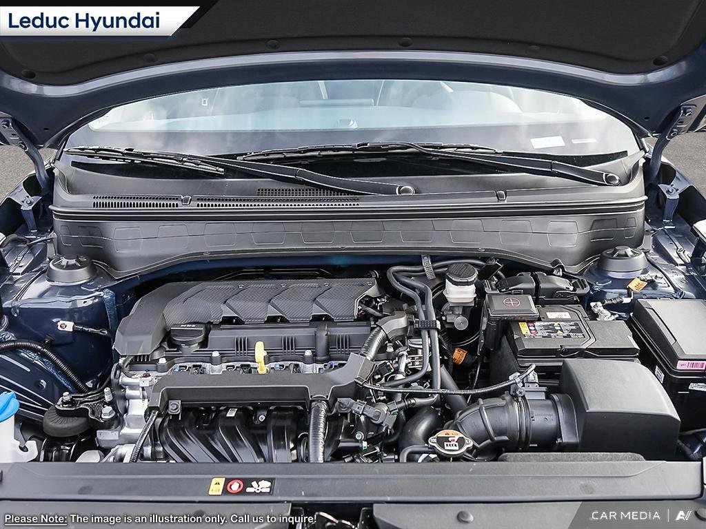 2025 Hyundai Venue Ultimate in Leduc, Alberta - 6 - w1024h768px