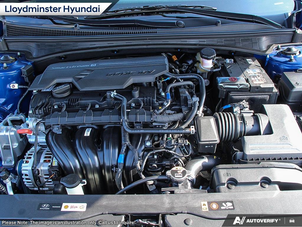 2025 Hyundai Elantra Luxury in Lloydminster, Saskatchewan - 6 - w1024h768px