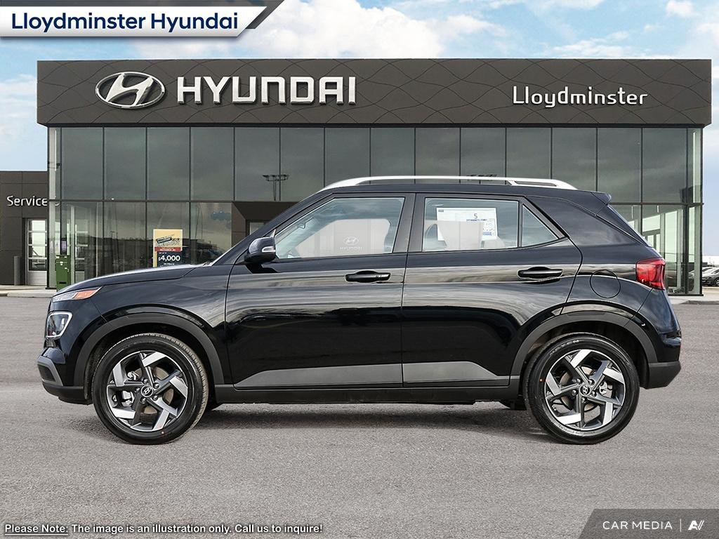 2025 Hyundai Venue Ultimate in Lloydminster, Saskatchewan - 3 - w1024h768px