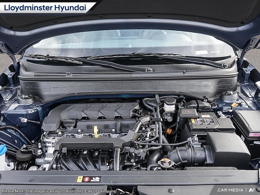 2025 Hyundai Venue Ultimate in Lloydminster, Saskatchewan - 6 - w1024h768px
