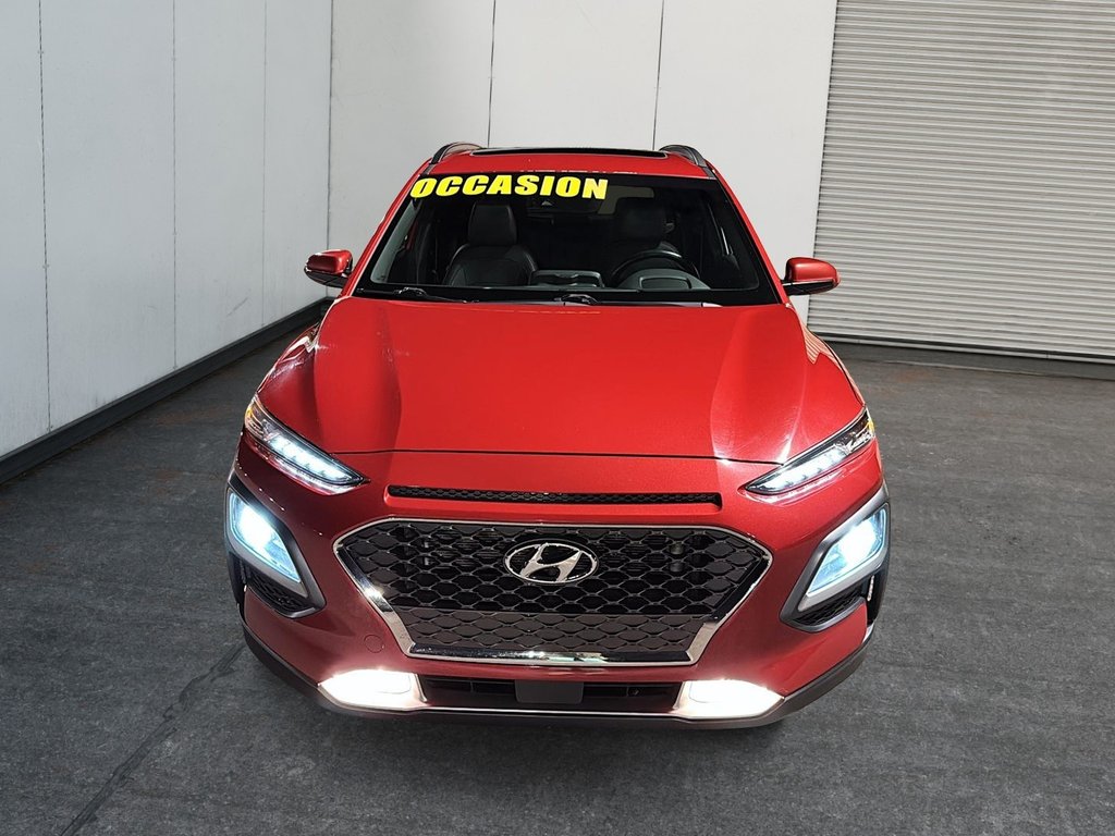 Hyundai Kona Ultimate 2020-1