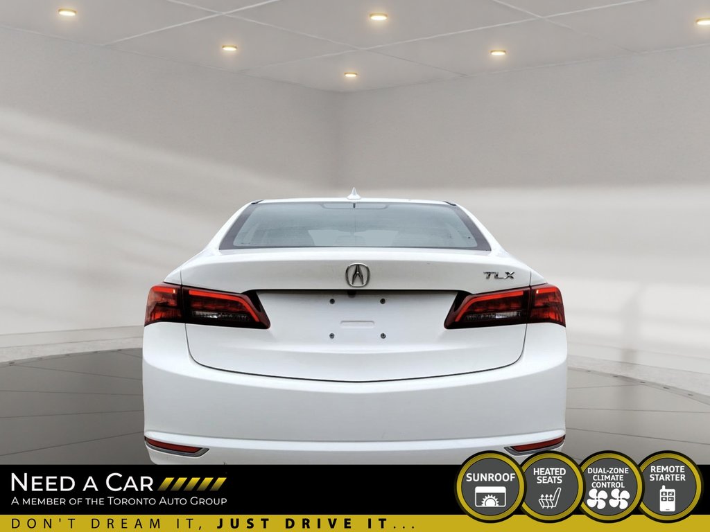 2017 Acura TLX BASE in Thunder Bay, Ontario - 3 - w1024h768px