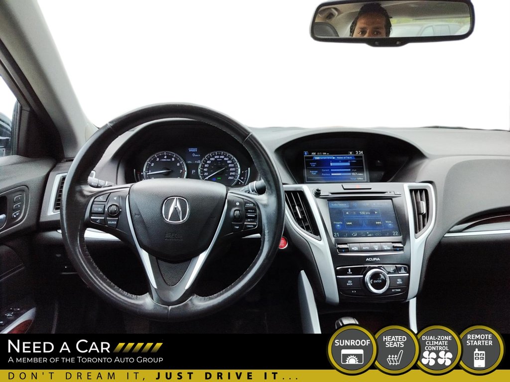 2017 Acura TLX BASE in Thunder Bay, Ontario - 10 - w1024h768px