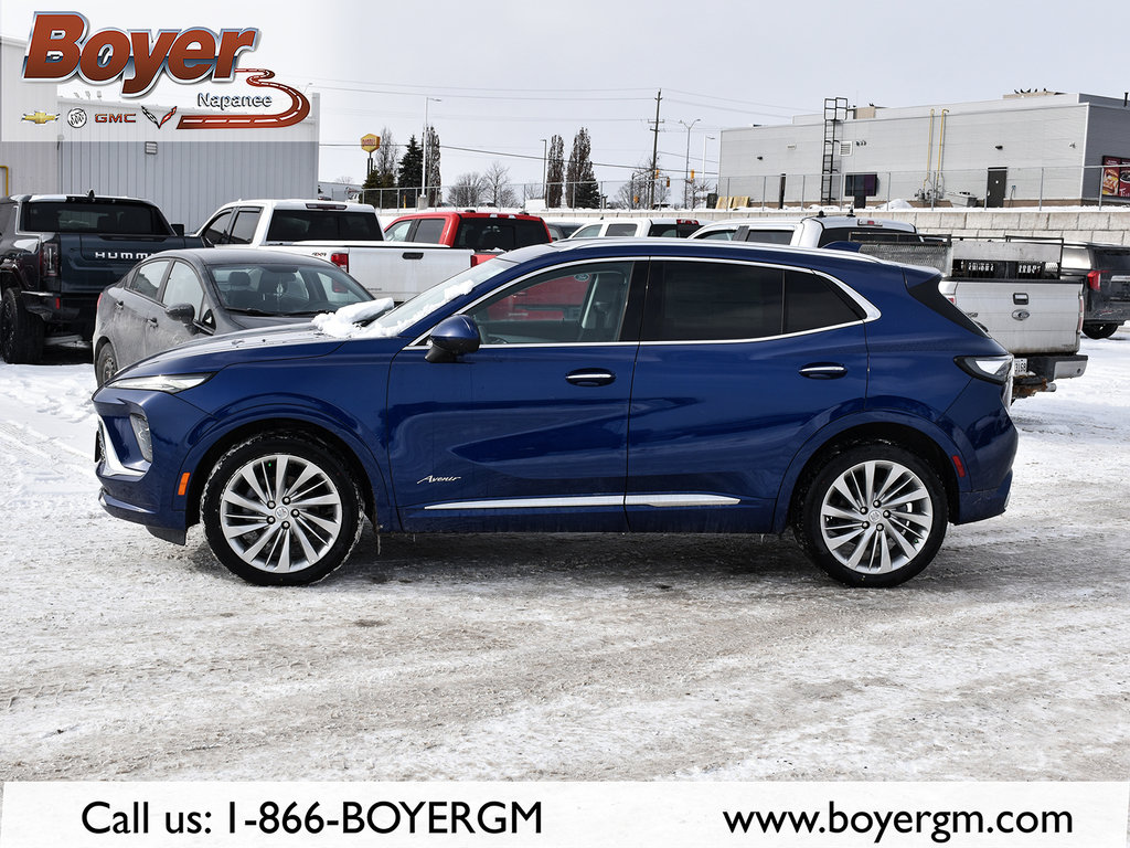 2024 Buick ENVISION in Pickering, Ontario - 5 - w1024h768px