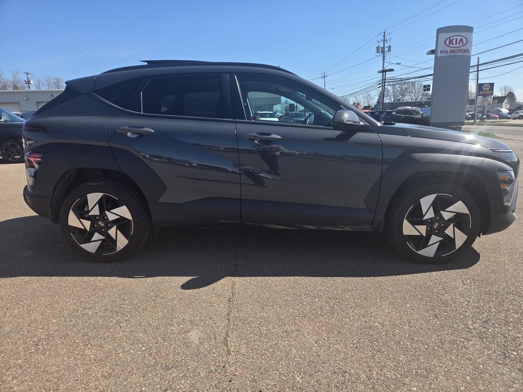 2025 Hyundai Kona Preferred Sport | SunRoof | Cam | Warranty to 2030 in Amherst, Nova Scotia - 4 - w1024h768px