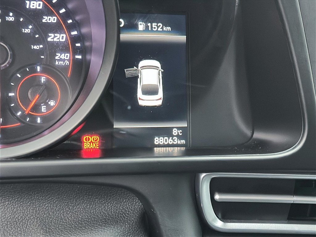 2022 Hyundai Elantra Sedan Ultimate IVT in Stratford, Ontario - 12 - w1024h768px