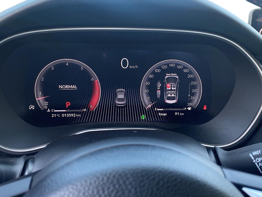 2025 Acura TLX Type S SH-AWD Sedan in Stratford, Ontario - 14 - w1024h768px