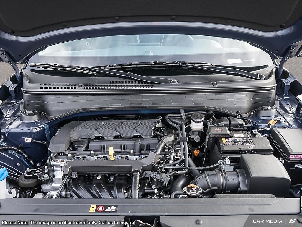 2025 Hyundai Venue Ultimate in Edmonton, Alberta - 6 - w1024h768px
