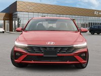 2025 Hyundai Elantra Preferred-1