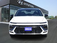 2024 Hyundai Sonata N Line-1