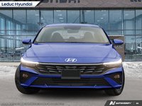 2025 Hyundai Elantra Preferred-1