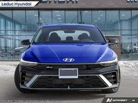 2025 Hyundai Elantra N-Line Ultimate-1