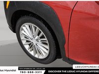 2021 Hyundai Kona 2.0L Preferred-2