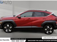 2024 Hyundai Kona 2.0L Preferred-4