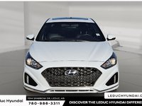 2018 Hyundai Sonata Sport-1