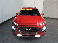 Hyundai Kona Ultimate 2020-1