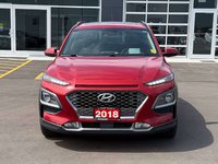 2018 Hyundai Kona 1.6T Ultimate-2