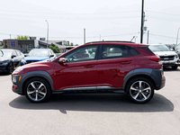 2018 Hyundai Kona 1.6T Ultimate-4