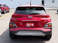 2018 Hyundai Kona 1.6T Ultimate-6