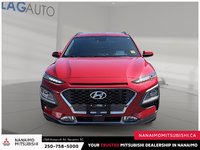 2021 Hyundai Kona 1.6T Ultimate-1