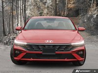 2026 Hyundai Elantra Preferred-1