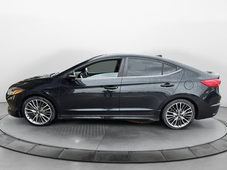 Hyundai Elantra  2018 à Baie-Comeau, Québec - 5 - w320h240px