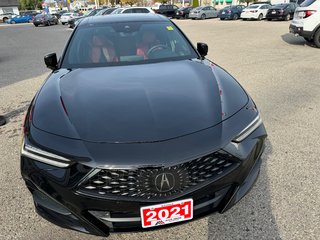 2021  TLX TECH  A-SPEC SH-AWD in Sarnia, Ontario - 4 - w320h240px