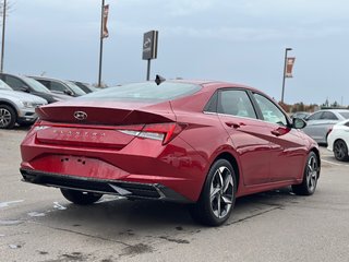 2021 Hyundai Elantra in Pickering, Ontario - 5 - w320h240px