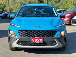 2022 Hyundai Kona in Pickering, Ontario - 5 - w320h240px