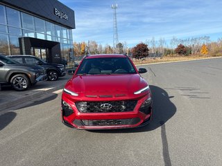 Hyundai Kona N Line 2022 à Bathurst, Nouveau-Brunswick - 2 - w320h240px