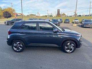 2026 Hyundai Venue Ultimate IVT w/Denim Interior in Bathurst, New Brunswick - 4 - w320h240px