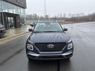 2026 Hyundai Venue Ultimate IVT w/Denim Interior in Bathurst, New Brunswick - 2 - w320h240px