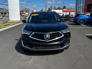 2019 Acura RDX PLATINUM ELITE in Amherst, Nova Scotia - 3 - w320h240px