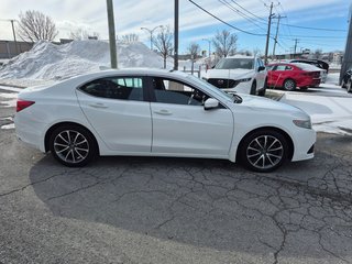 Acura TLX V6 Tech 2017