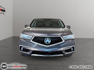 MDX Elite Pkg 2017 à Granby, Québec - 2 - w320h240px