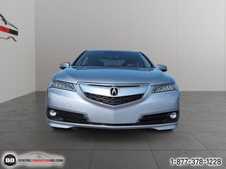 2017 Acura TLX in Granby, Quebec - 2 - w320h240px