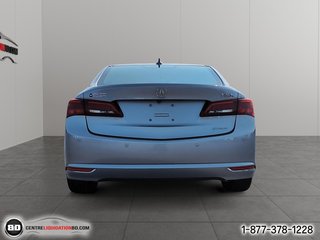 2017 Acura TLX in Granby, Quebec - 6 - w320h240px