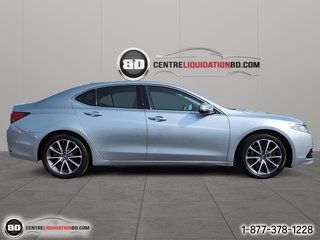 2017 Acura TLX in Granby, Quebec - 4 - w320h240px