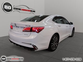 Acura TLX Tech SH-AWD V6 3.5L 2018 à Granby, Québec - 5 - w320h240px