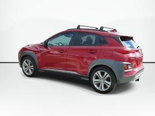 2021 Hyundai Kona Ultimate | Sunroof | Leather | Cam in Saint John, New Brunswick - 6 - w320h240px