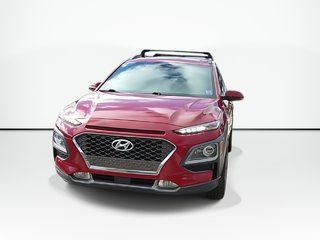 2021 Hyundai Kona Ultimate | Sunroof | Leather | Cam in Saint John, New Brunswick - 3 - w320h240px