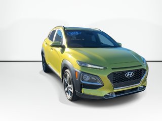 Hyundai Kona Ultimate | Lthr | Roof | Nav | HtdSeats | Cam 2019 à Saint John, Nouveau-Brunswick - 2 - w320h240px