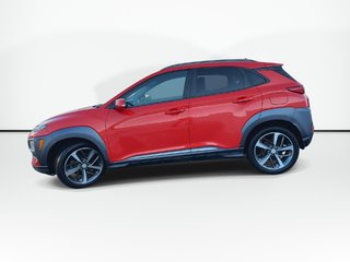 2020 Hyundai Kona Ultimate | Cam | Lthr | HtdSeats | Bluetooth | USB in Saint John, New Brunswick - 5 - w320h240px
