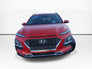 2020 Hyundai Kona Ultimate | Cam | Lthr | HtdSeats | Bluetooth | USB in Saint John, New Brunswick - 3 - w320h240px