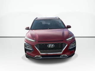 2021 Hyundai Kona Trend | Roof | HtdSeat | Cam | Warranty to 2026 in Saint John, New Brunswick - 3 - w320h240px